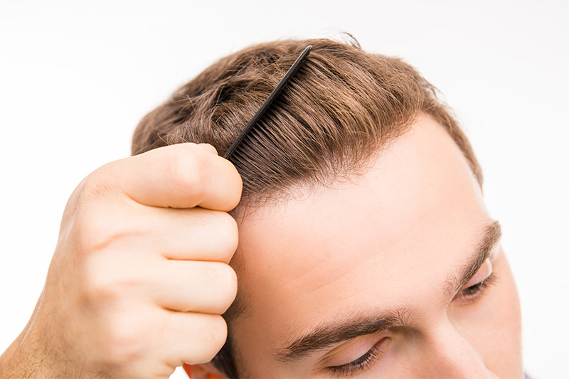 Hair Transplant Aftercare